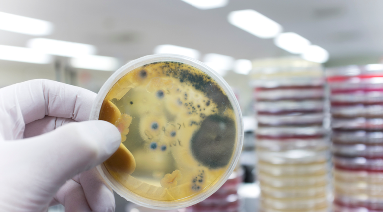 140 egunetan plastikoa deskonposatzeko gai den onddoa aurkitu dute