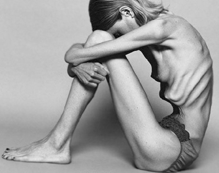 Anorexia eta bulimiaren aldeko 500.000 webgune Anorexia eta bulimiaren aldeko 500.000 webgune