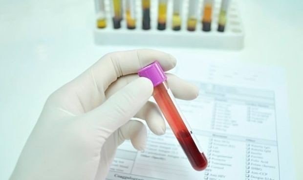 Depresio maila odol analisi bitartez diagnostikatzeko teknika berri bat garatu dute Depresio maila odol analisi bitartez diagnostikatzeko teknika berri bat garatu dute