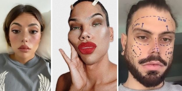 Instagramek kirurgia estetikoko filtroak ezabatu nahi ditu Instagramek kirurgia estetikoko filtroak ezabatu nahi ditu