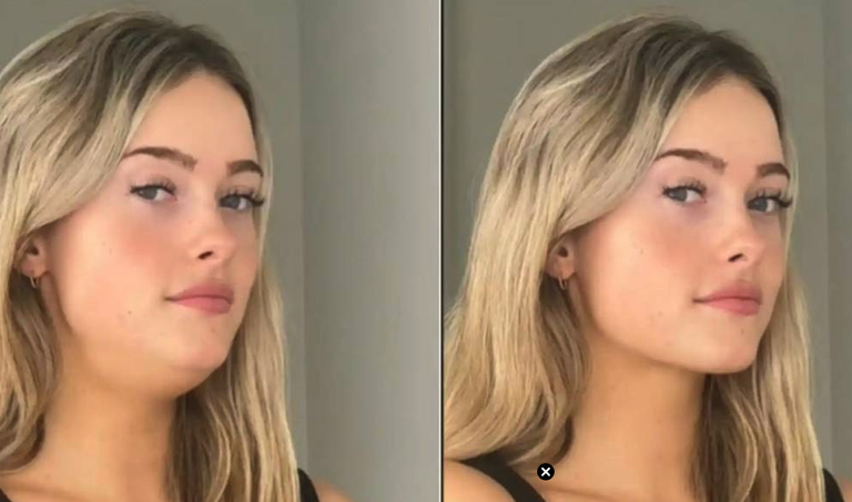 "Mewing": teknika edergarria edo enegarren gezur mediatikoa?