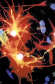 Neurona gehien dituzten animaliak Neurona gehien dituzten animaliak