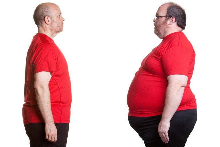 Obesitatea: ba ote dakigu zer den? Obesitatea: ba ote dakigu zer den?