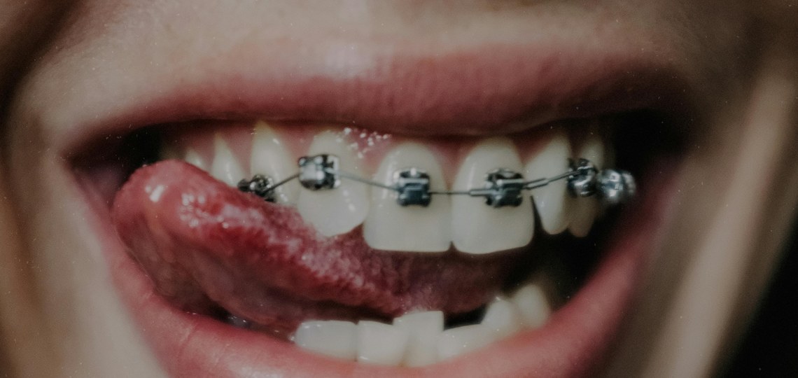 HORTZ-APARATUA JARRI AURRETIK JAKIN BEHARREKOAK